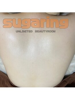 アンリミテッド ビューティールーム(UNLIMITED BEAUTYROOM)/-お背中シュガーリング-