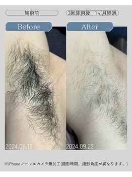 ジールクス 太田店(G LUX)/ワキ