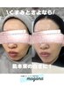 【HPB限定】シミケア20分×フェイスクリーニング