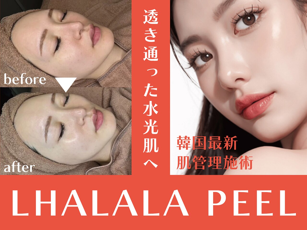 ❤毛穴対策に特化❣7in1超多機能な最新最先端エステサロンモデル♪❤美顔器 深谷市で毛穴洗浄・毛穴吸引が人気のエステサロン｜ホットペッパー