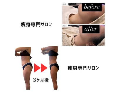 エードット(A.)の写真