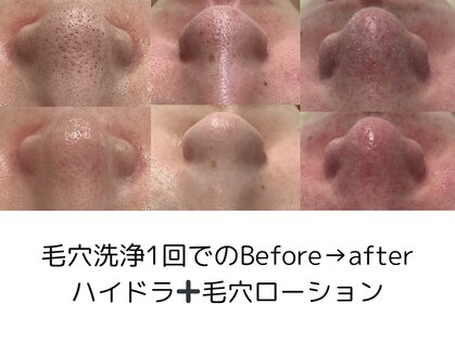 リンフェイス 表参道(RIN FACE)の写真
