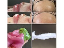 シャルム 広島店(CHARME)の雰囲気（《フェイスWax》産毛＆角質オフ！肌トーンアップでつるん肌に！）