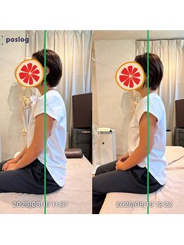 グレフル鍼灸接骨院 整体院 心斎橋/整体/肩こり/マッサージ/腰痛