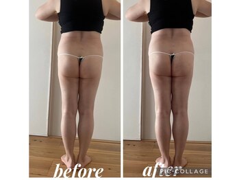 クリオネ(Clione)/愛されヒップ