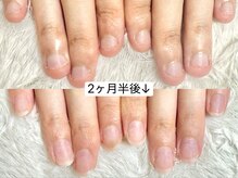 グラシナ なんば店/深爪/自爪育成/フィルイン