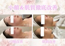 上野エステサロン レア(Lea)