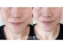 レディースカイロプラクティックカーム(calm)