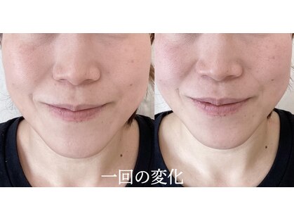 レディースカイロプラクティックカーム(calm)の写真