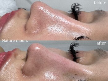 ナチュールムーン(Nature moon.)/毛穴洗浄