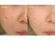 クラティス マヴィ(Clatisse Mavie)の写真/毛穴のケア・ざらつきに☆【フェイシャルWax】で産毛&角質オフ！パッと明るいツルツル素肌へ♪