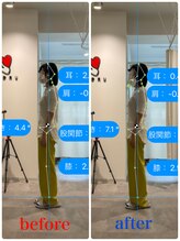 ナオル整体 新宿院(NAORU整体)/30代女性-姿勢矯正 3ヶ月経過