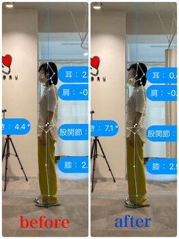 ナオル整体 新宿院(NAORU整体)/30代女性-姿勢矯正 3ヶ月経過
