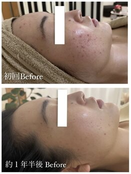 ルルボーテ(Loulou Beaute)/waxxxx+VOSサロンケア