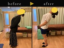 杉本接骨鍼灸院/急なギックリでも、すぐに楽に