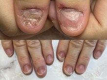 ウーナ ルーセント(UUNA LUCENT)の雰囲気（深爪、爪の形、爪のダメージなど爪の悩みご相談ください。）