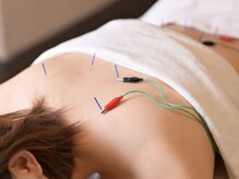 アキュレ(Acure)/★お身体への鍼★