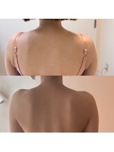 プレジール(Plaisir)/アロマトリートメント