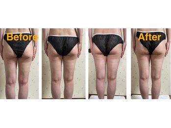 ラレコルト/ビフォーアフター