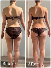 リッシュボーテ(RICHE BEAUTE)/【広尾/リンパマッサージ/痩身】