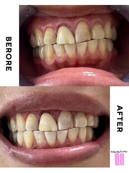 エクシアホワイトニング 王寺店/