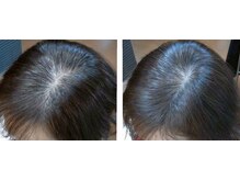 ピエリ ザ ビューティステイション 春日原店(Pierie THE BEAUTY STATION)/ヒト幹細胞スパ