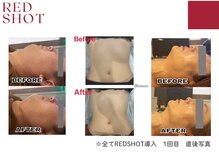 ブロッサム 天神 春吉(Blossom)の雰囲気（『顔も身体も、1回の施術で驚くほど実感。』REDSHOT）