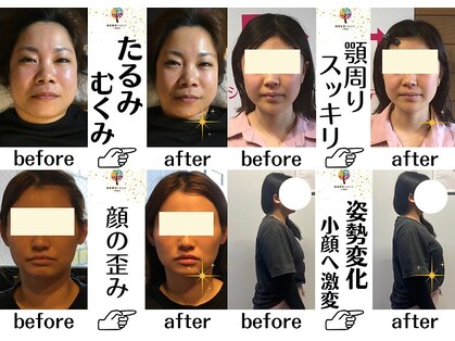 クレスト(CREST)の写真