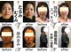 クレスト(CREST)の写真