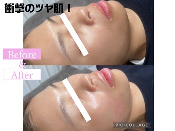 カンナムビューティー/ララピールで衝撃の水光ツヤ肌!