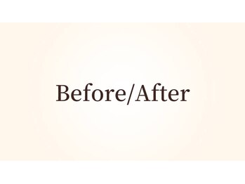 コスメティック雅/●Before/After