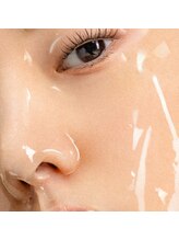 サロンド エステ ミニョン(salon de esthe mignon)/ラミネーションピール！肌育