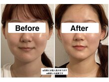 １回でも体感してもらえますが、継続する事でより効果がでます！