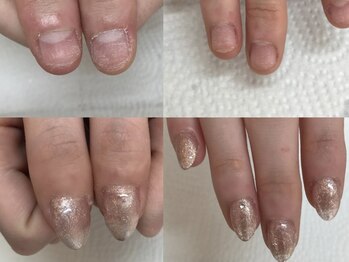 クラッシー(classy)/深爪にも長さだし対応!