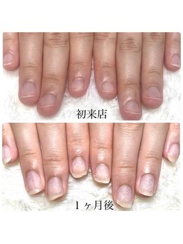 グラシナ 鳥丸店/是非ご相談ください