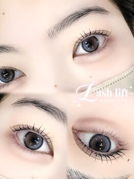 ルーフアイ(ROOF EYE)/ROOF EYE(ルーフ アイ)