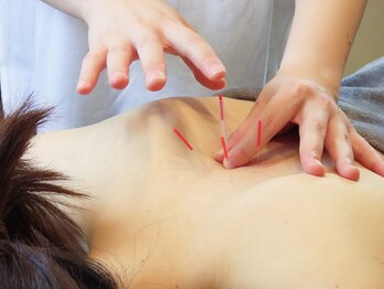 グッドビューティー(GOOD BEAUTY)/首肩こり冷え改善鍼灸