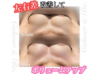 カルマーアンドビー(Calmer & Be.)/【バスト】Before/After