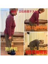 リファイン(Refine)/腰痛で前かがみができない