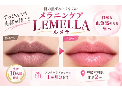 ホワイトニング ハナ 大阪本町店(Whitening Hana)の写真