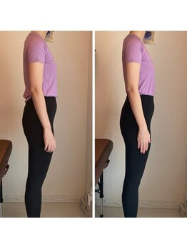 ザ エスアップ 博多店(THE S-UP)/施術前後写真