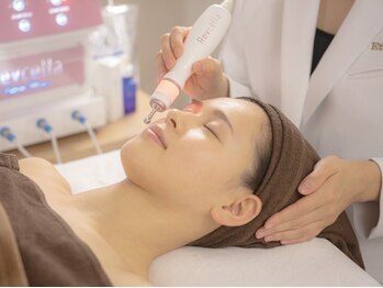 ココ(COCO)の写真/【何をしても改善しなくて諦めていた方に！】あらゆる肌悩みの根本にアプローチ！年齢を感じさせない肌に♪