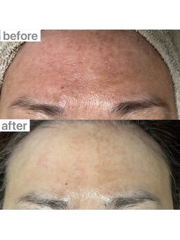 ユイット ルッカ(Huit Lucca)/ハイドラ×ララピール