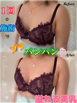 カルマーアンドビー(Calmer & Be.)/【バスト】Before/After