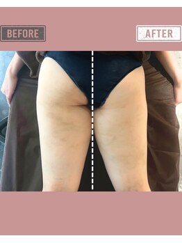 マーリエ(Malie)/【オールハンド】太もも～ヒップ