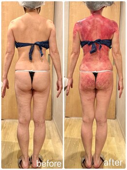 スピード美人 本八幡店/筋膜リリースで全身変わる