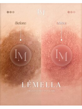 ハニー(Honey)/バストアップサロンHONEY恵比寿