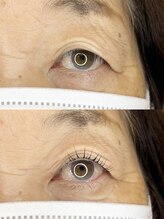 ダーム ド ローズ(Dame de rose)/【まぶたが上がるまつ毛パーマ】