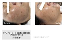 サロン シェリー 大島(Salon Cherie)