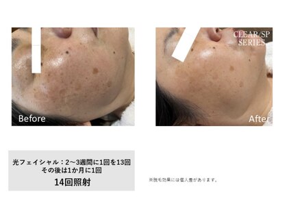 サロン シェリー 大島(Salon Cherie)の写真
